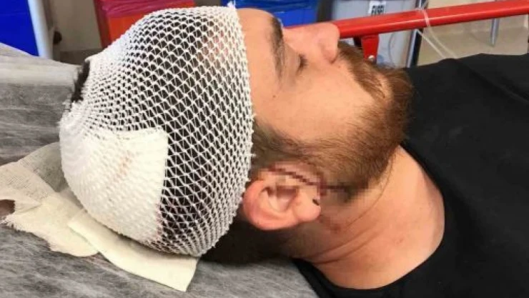 Meslektaşımıza Trafikte Saldırı